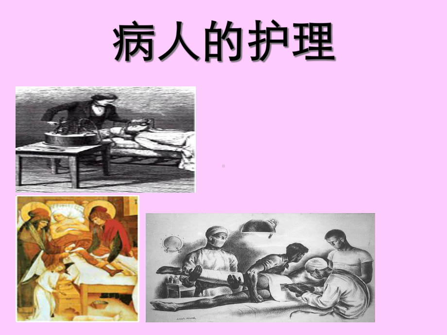 全麻病人护理模板课件.ppt_第2页