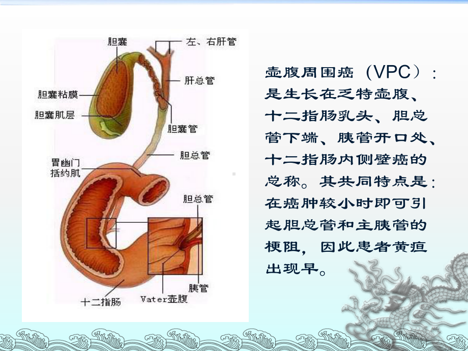 医学课件-壶腹周围癌病例讨论教学课件.ppt_第2页