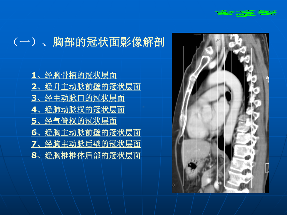 医学胸部冠状面矢状面解剖与影像培训课件.ppt_第2页