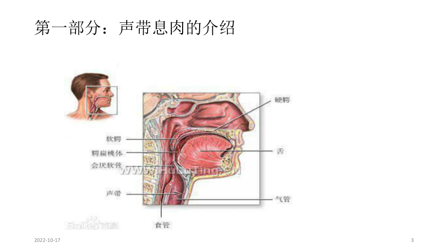 声带息肉患者护理查房参考课件.ppt_第3页