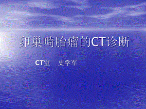 卵巢畸胎瘤CT诊断-课件.pptx