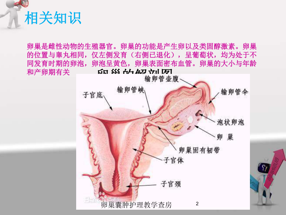 卵巢囊肿护理教学查房培训课件.ppt_第2页