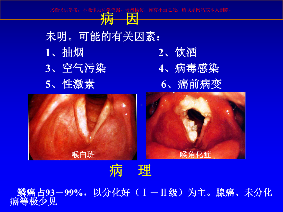 喉癌医学知识培训课件.ppt_第2页