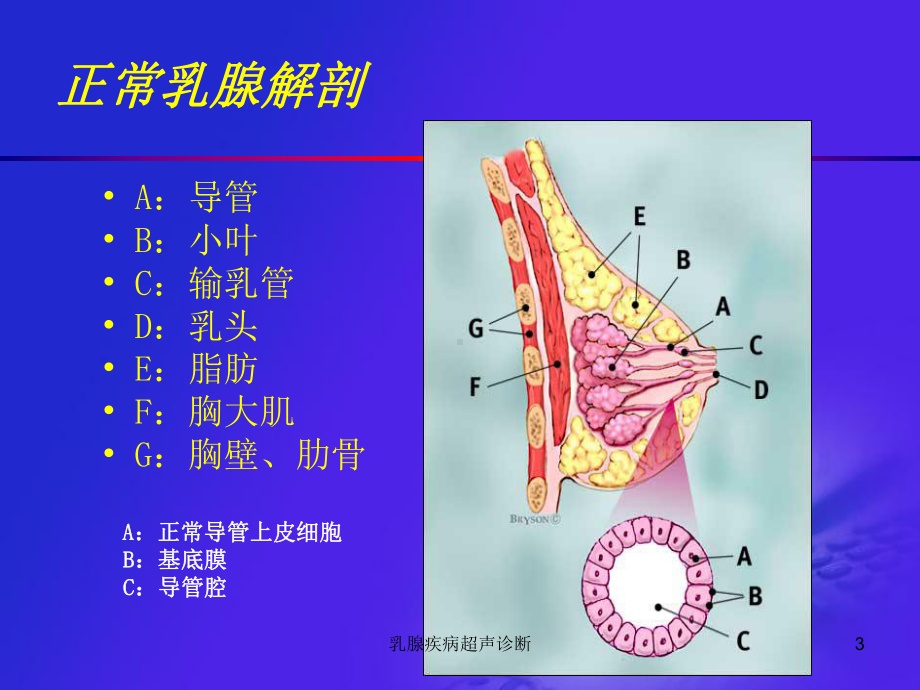 乳腺疾病超声诊断课件.ppt_第3页