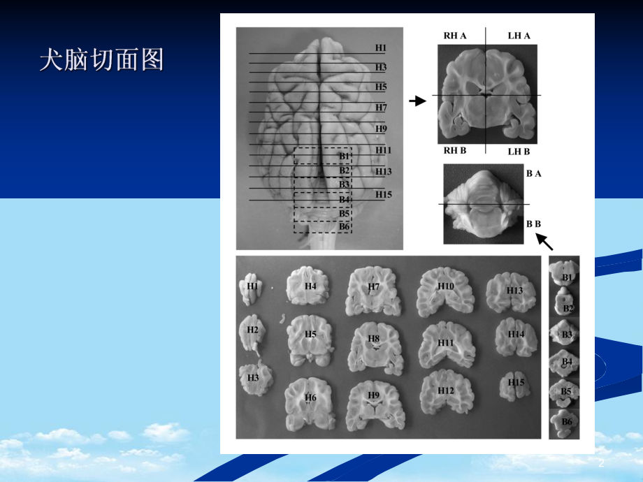 内科神经系统教学大全综述课件.ppt_第2页