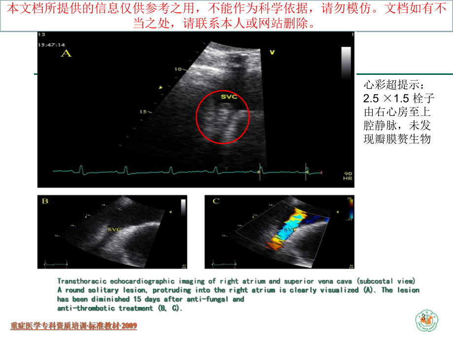 导管相关性感染已看有必要再看培训课件.ppt_第3页