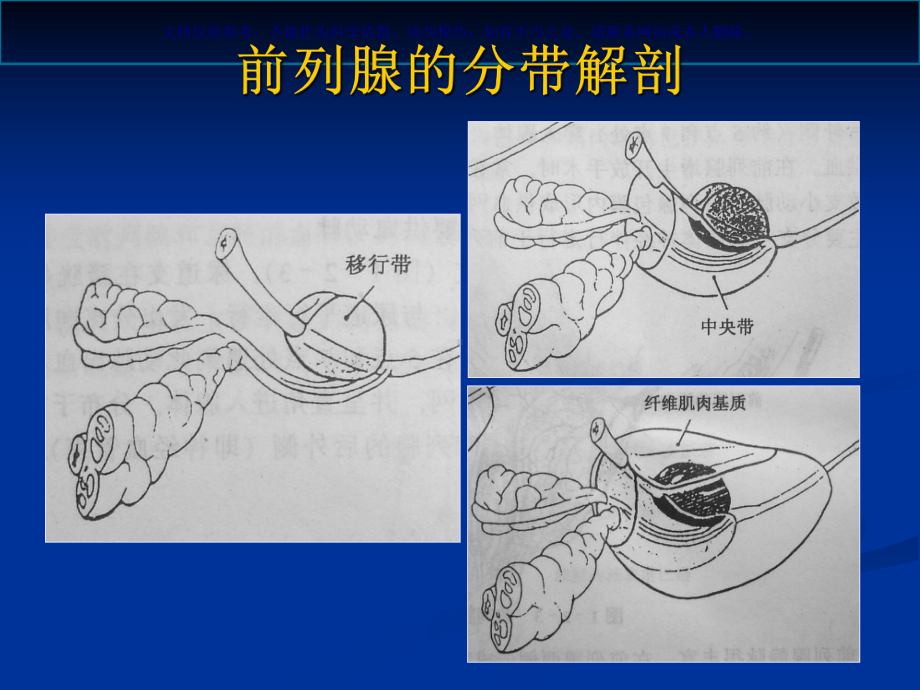 前列腺的MR检查课件.ppt_第3页