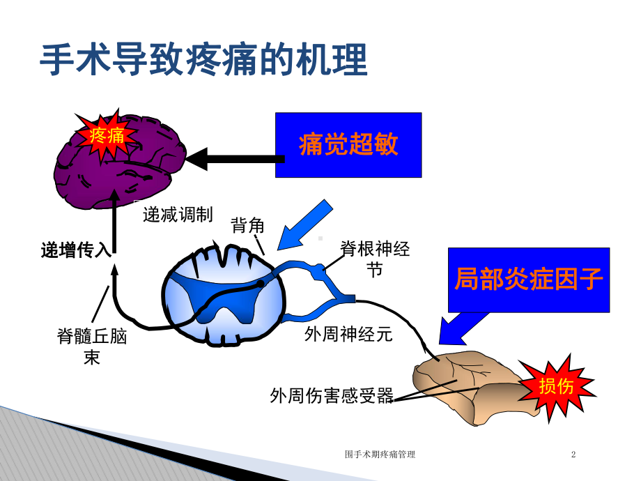 围手术期疼痛管理培训课件.ppt_第2页