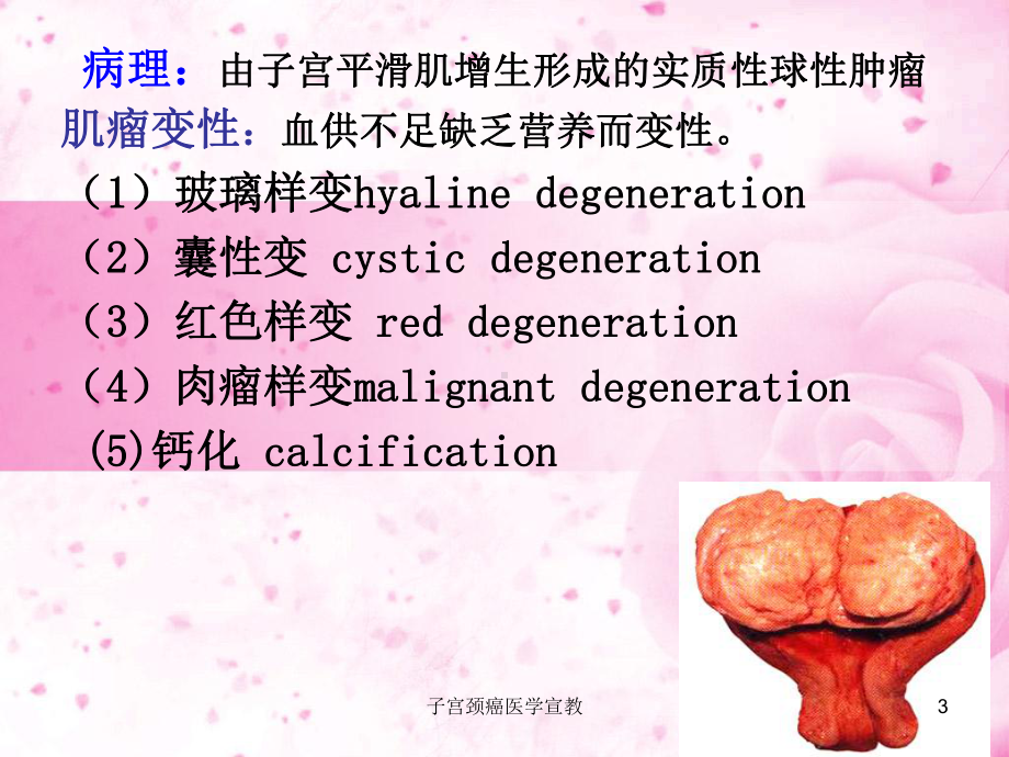 子宫颈癌医学宣教培训课件.ppt_第3页