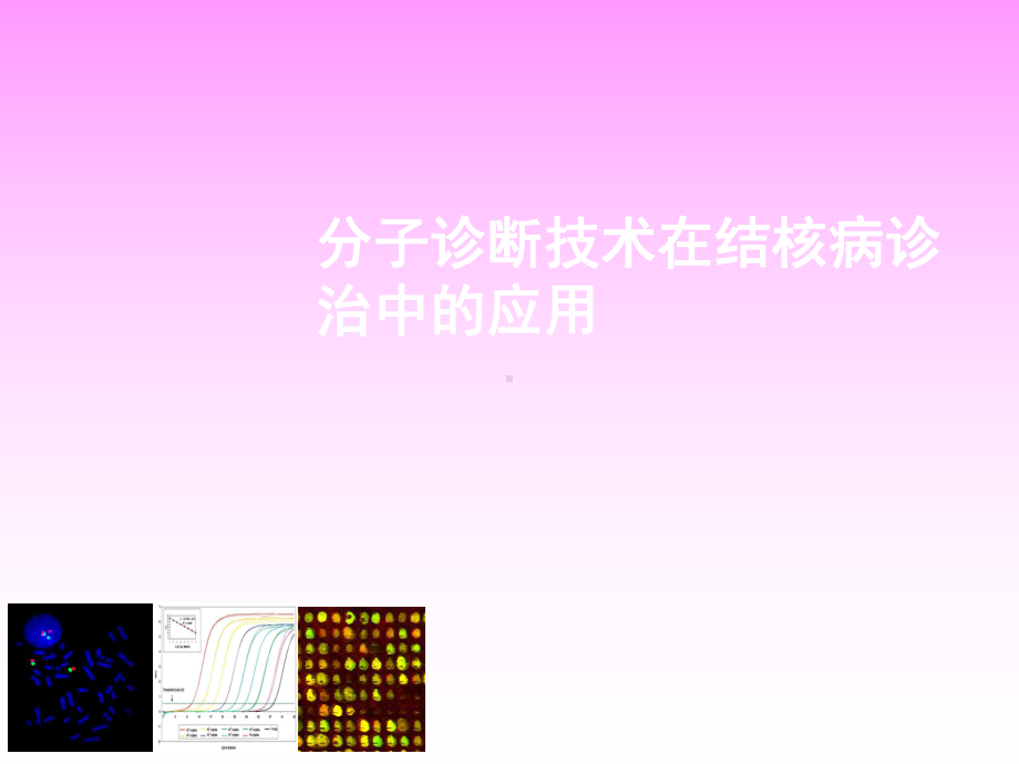 分子诊断技术在结核病诊治中应用课件.ppt_第1页