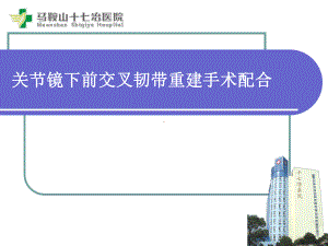 关节镜下前交叉韧带重建手术配合课件.pptx