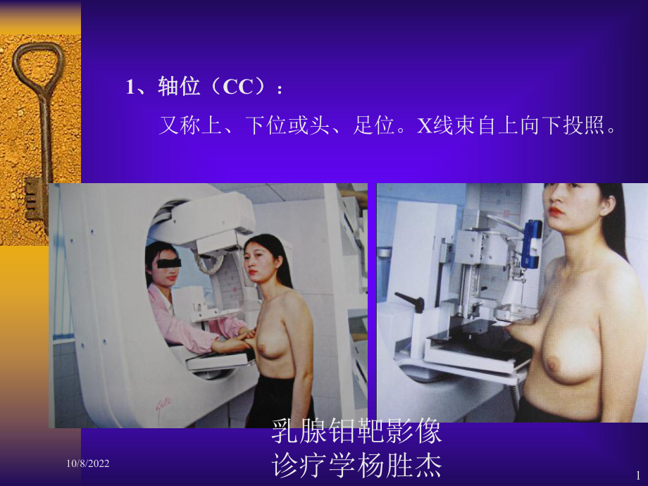 乳腺钼靶影像诊疗学课件.ppt_第1页