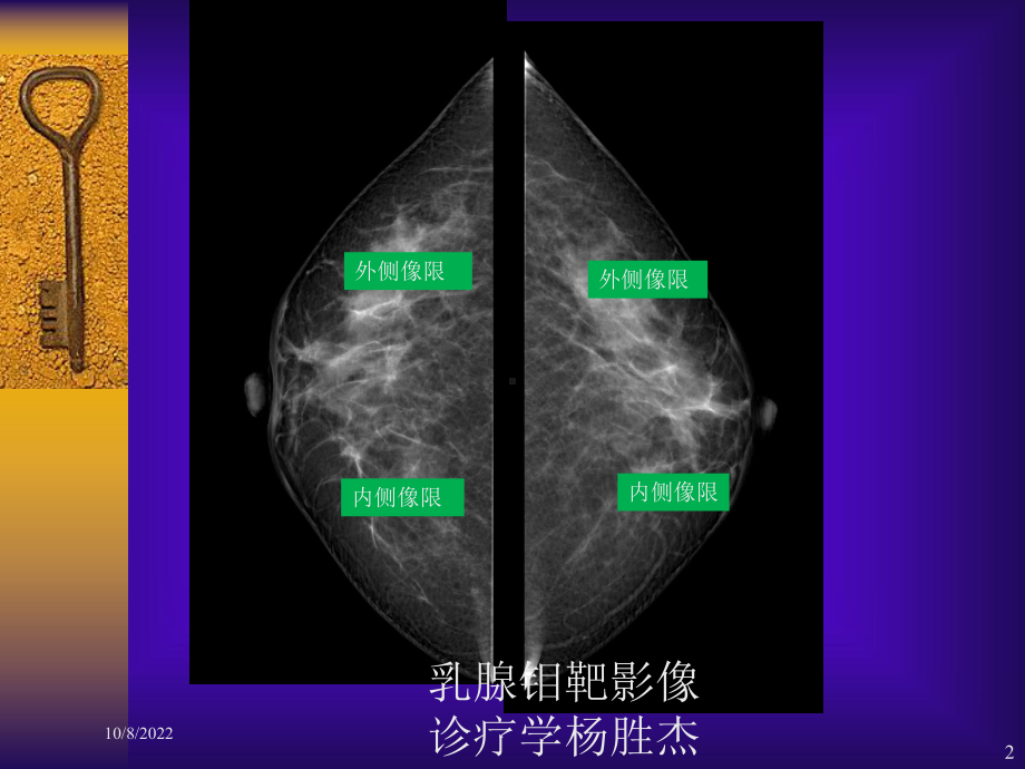 乳腺钼靶影像诊疗学课件.ppt_第2页