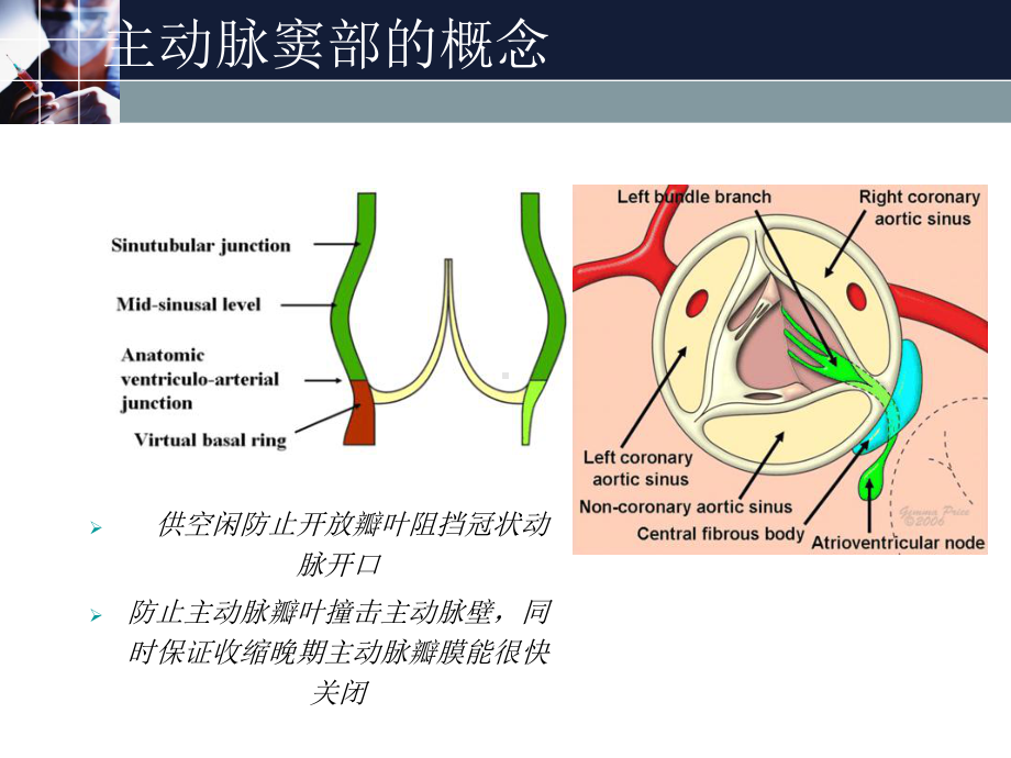 主动脉窦动脉瘤(Valsalva窦动脉瘤)课件.pptx_第3页