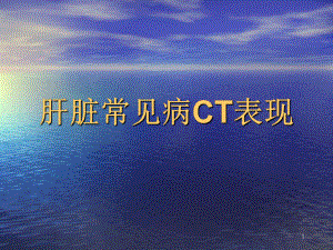 医学课件-肝脏常见疾病CT诊断课件.ppt