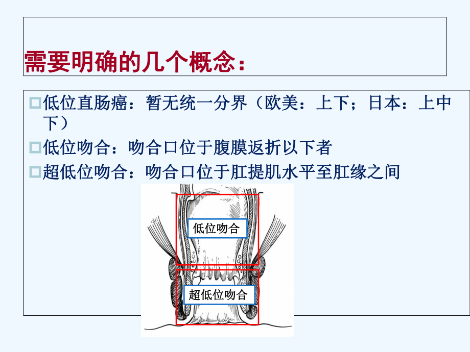 低位直肠癌术式选择及技巧课件.ppt_第3页