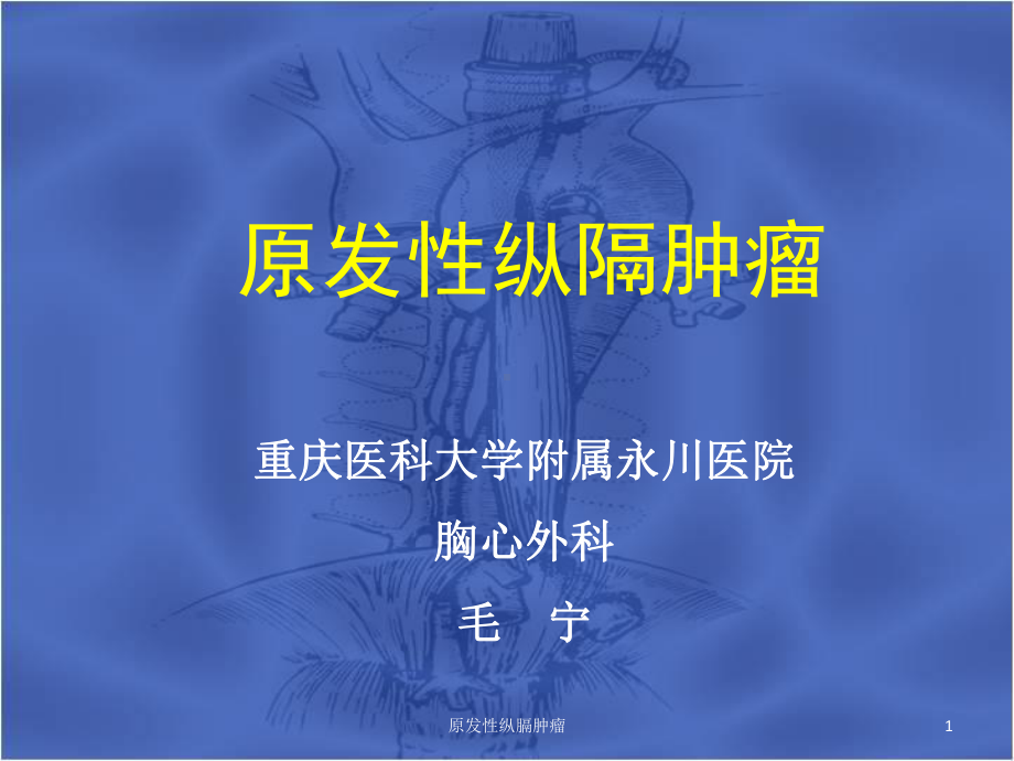 原发性纵膈肿瘤课件.ppt_第1页