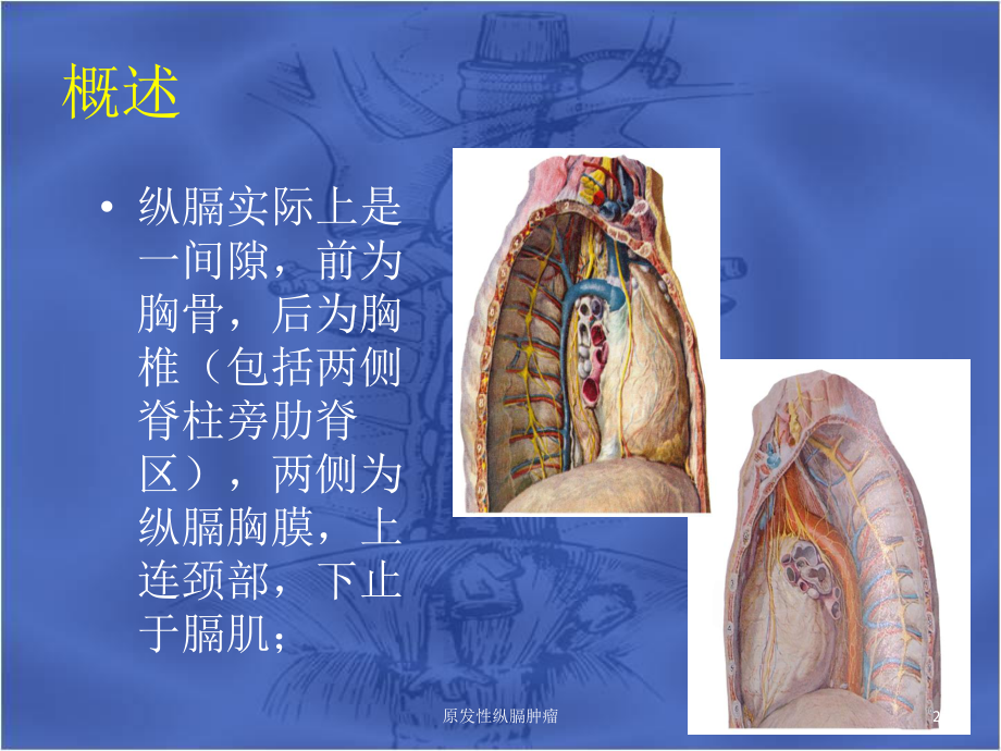 原发性纵膈肿瘤课件.ppt_第2页