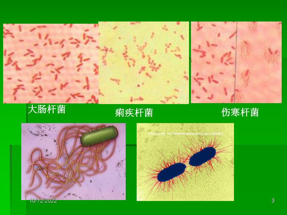 基础微生物肠杆菌科细菌课件.ppt_第3页