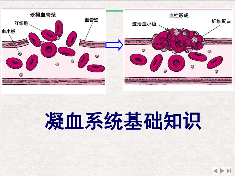 凝血异常与课件.ppt_第3页