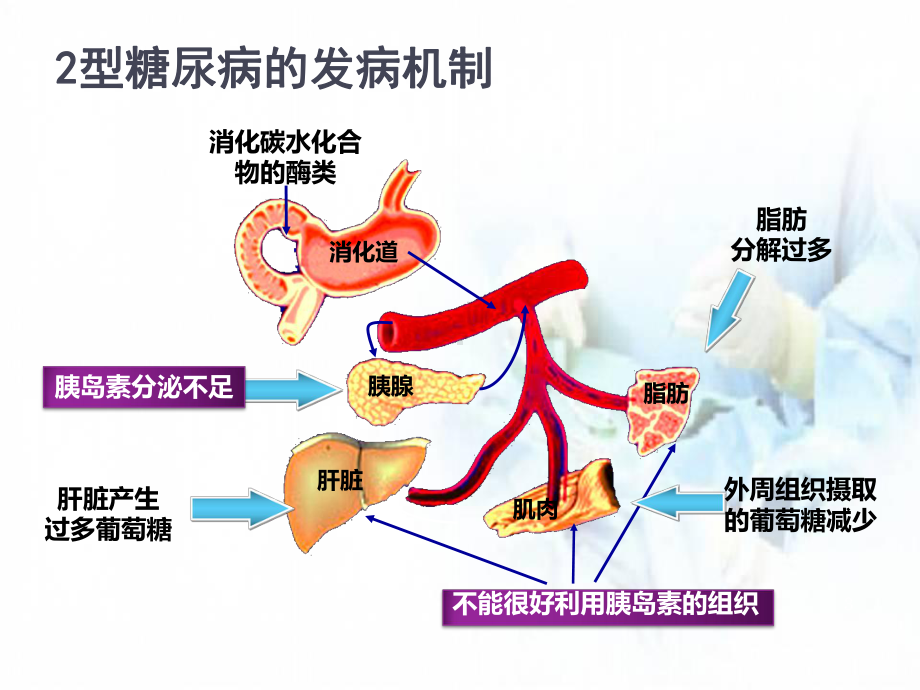 医学课件-2型糖尿病口服药治疗课件.ppt_第3页