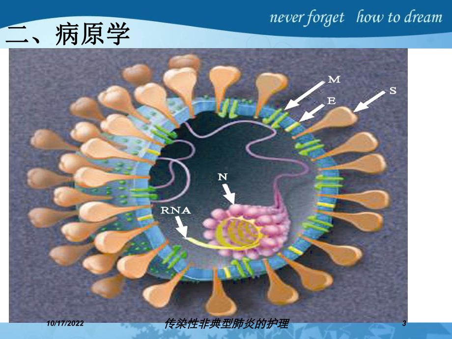 传染性非典型肺炎的护理培训课件.ppt_第3页