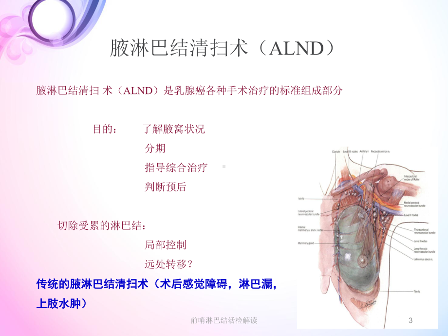 前哨淋巴结活检解读培训课件.ppt_第3页