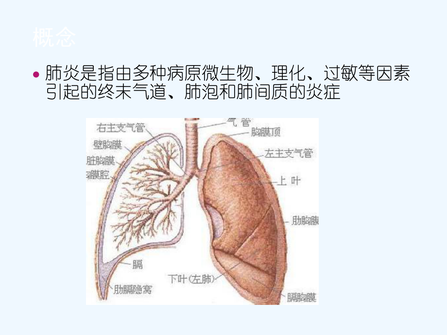 呼吸科护理查房肺炎课件.ppt_第3页