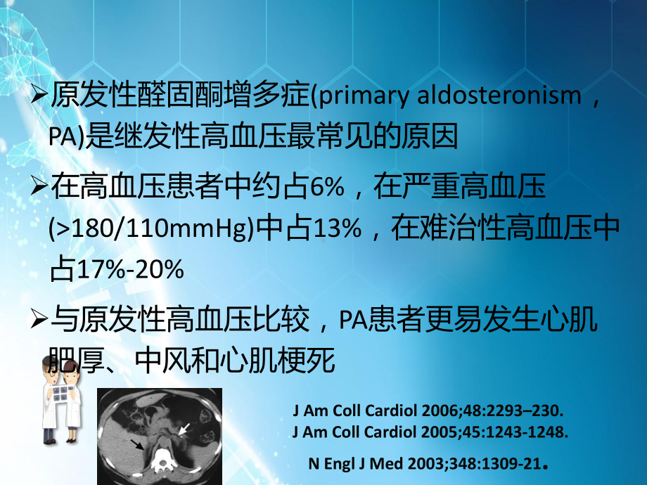 分侧肾上腺静脉取课件.pptx_第2页