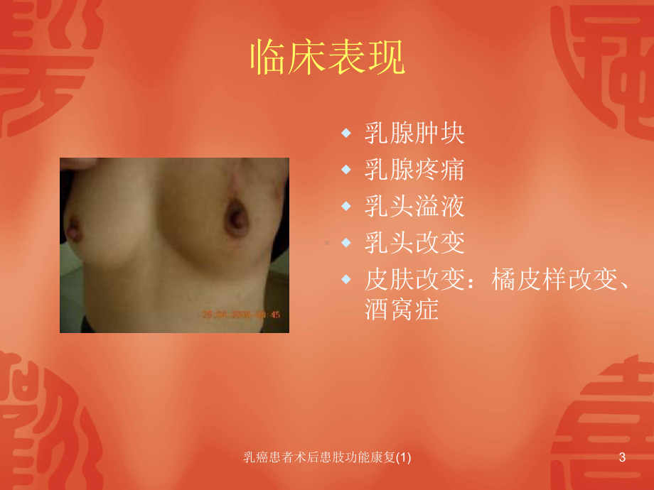 乳癌患者术后患肢功能康复课件1.ppt_第3页