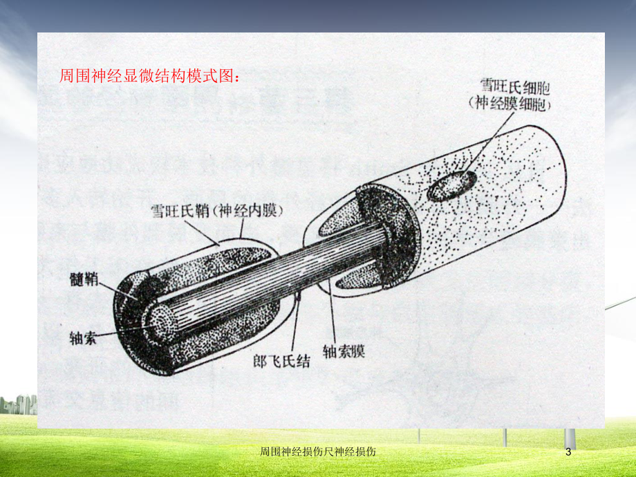 周围神经损伤尺神经损伤培训课件.ppt_第3页