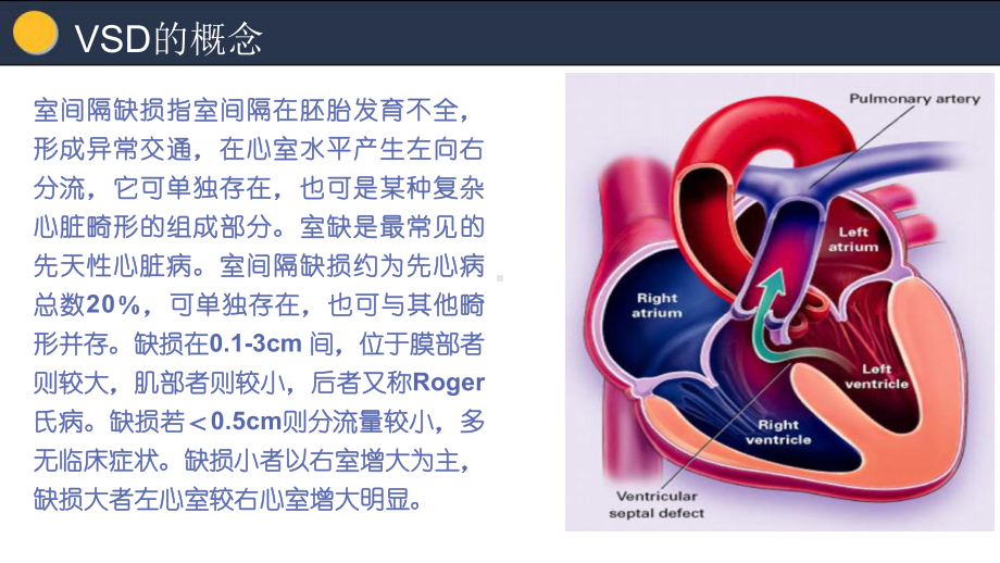 室间隔缺损护理查房-课件.pptx_第3页