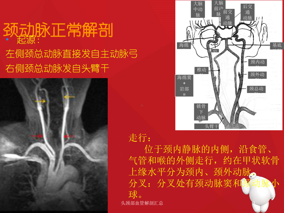 头颈部血管解剖汇总培训课件.ppt_第3页