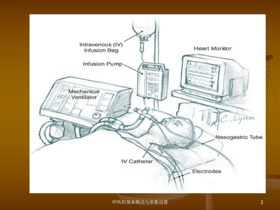 呼吸机基本模式与参数设置培训课件.ppt_第2页