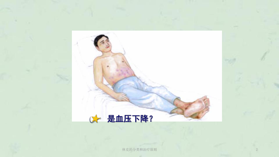 休克的分类和治疗原则课件.ppt_第2页