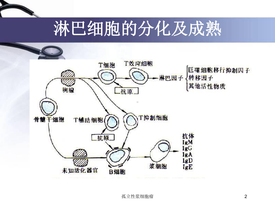 孤立性浆细胞瘤培训课件.ppt_第2页