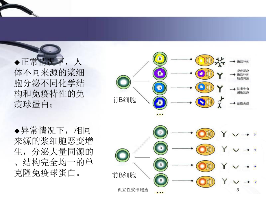 孤立性浆细胞瘤培训课件.ppt_第3页