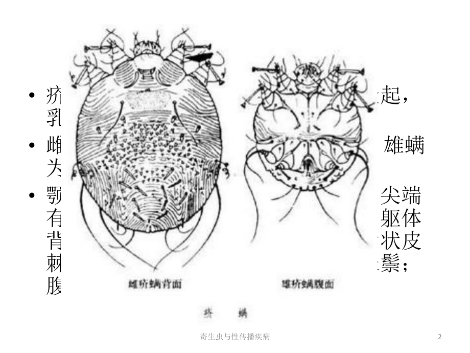 寄生虫与性传播疾病课件.pptx_第2页