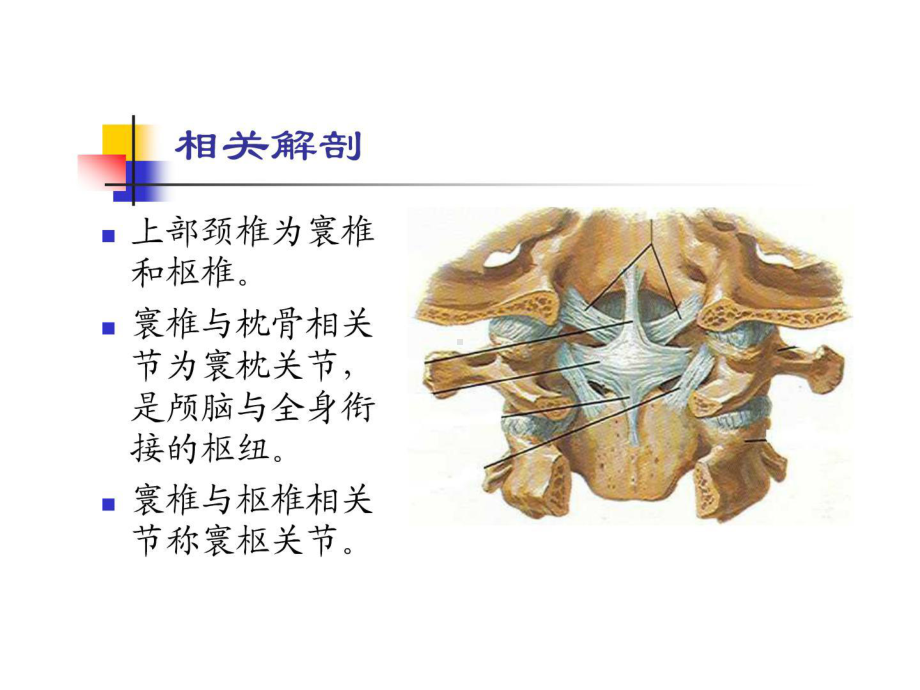 寰枢关节错位型颈椎病课件.ppt_第3页