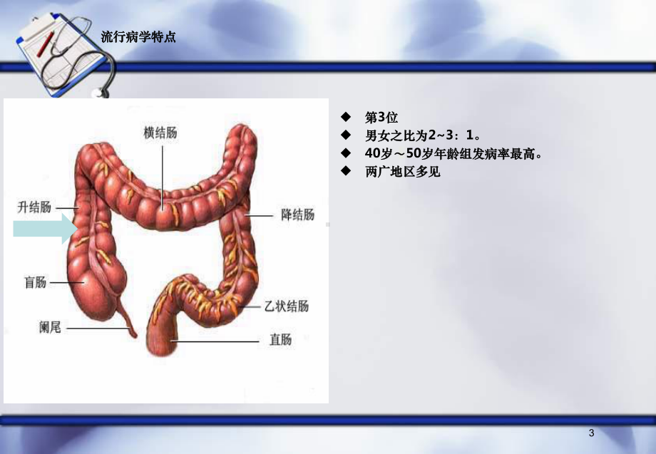 升结肠癌护理查房课件.ppt_第3页