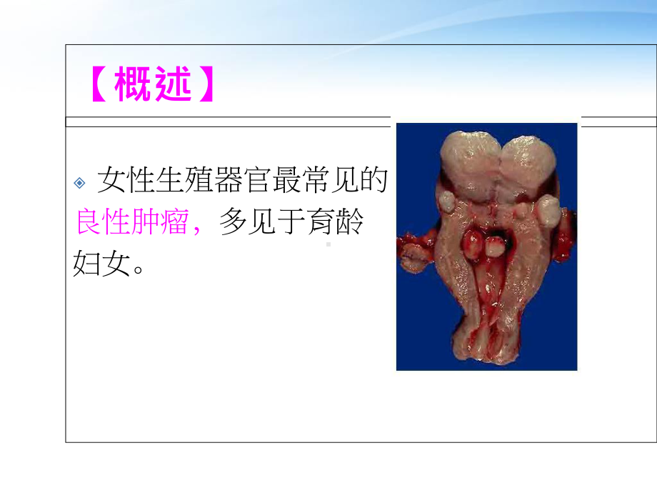 子宫肌瘤病人的术后护理-课件.ppt_第3页