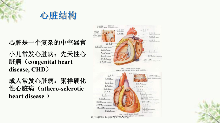 先天性心脏病课件-2.ppt_第3页