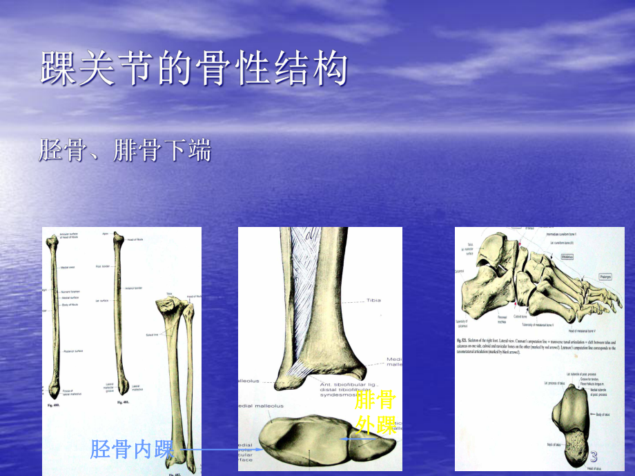 全踝关节置换术课件.ppt_第3页