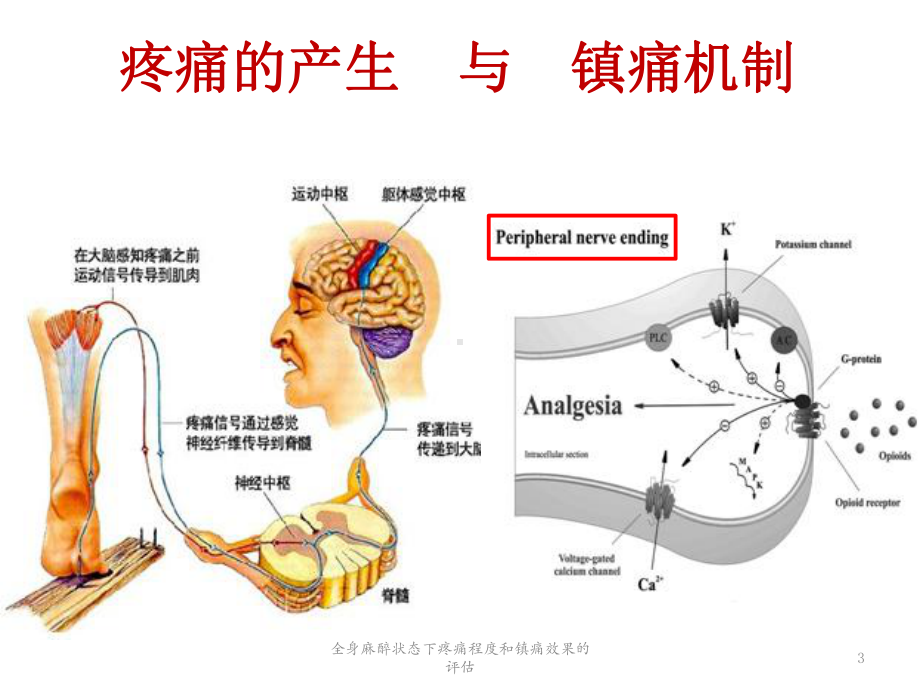 全身麻醉状态下疼痛程度和镇痛效果的评估培训课件.ppt_第3页