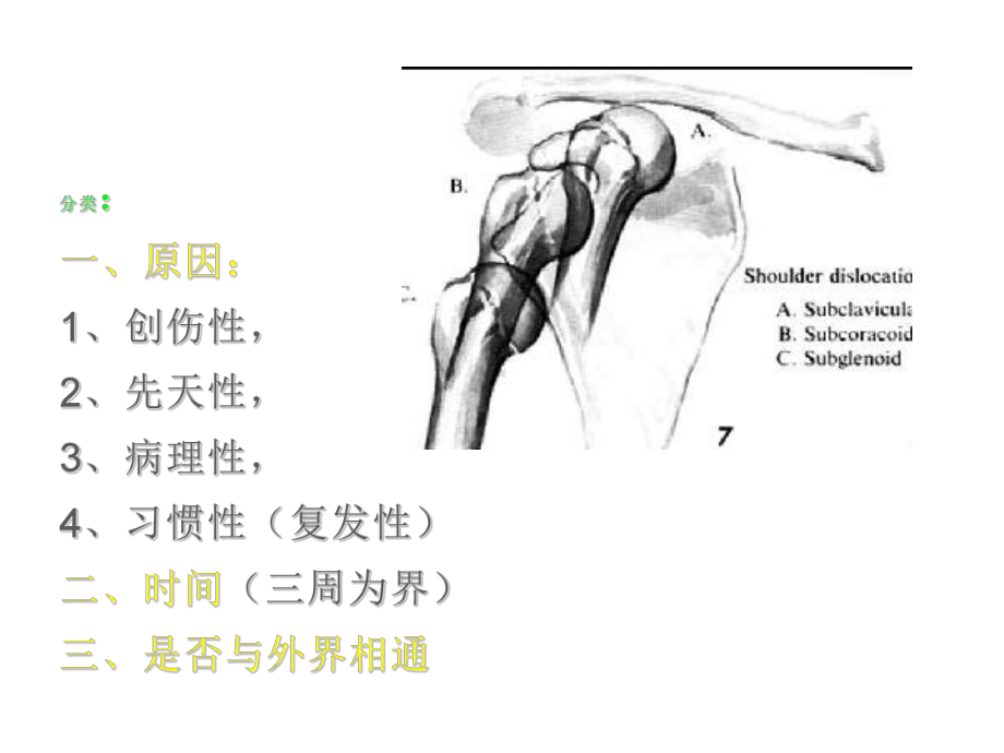 关节损伤-医药类课件.ppt_第3页