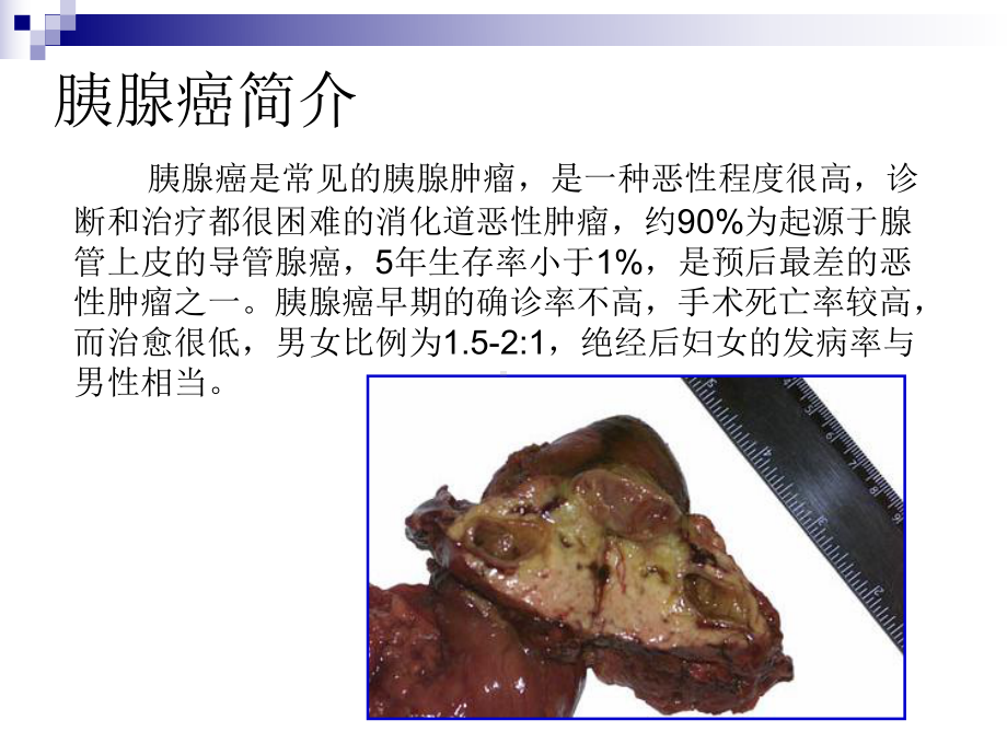 医学胰腺癌围手术期护理专题培训课件.ppt_第3页