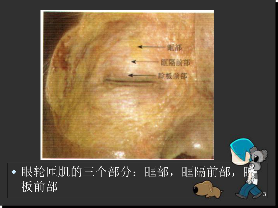 医学课件-眼睑解剖课件.ppt_第3页