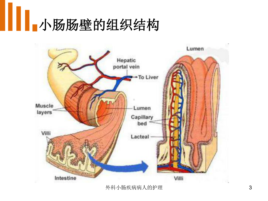 外科小肠疾病病人的护理课件.ppt_第3页