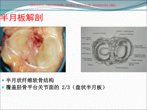 半月板损伤专业医学知识宣讲课件.ppt