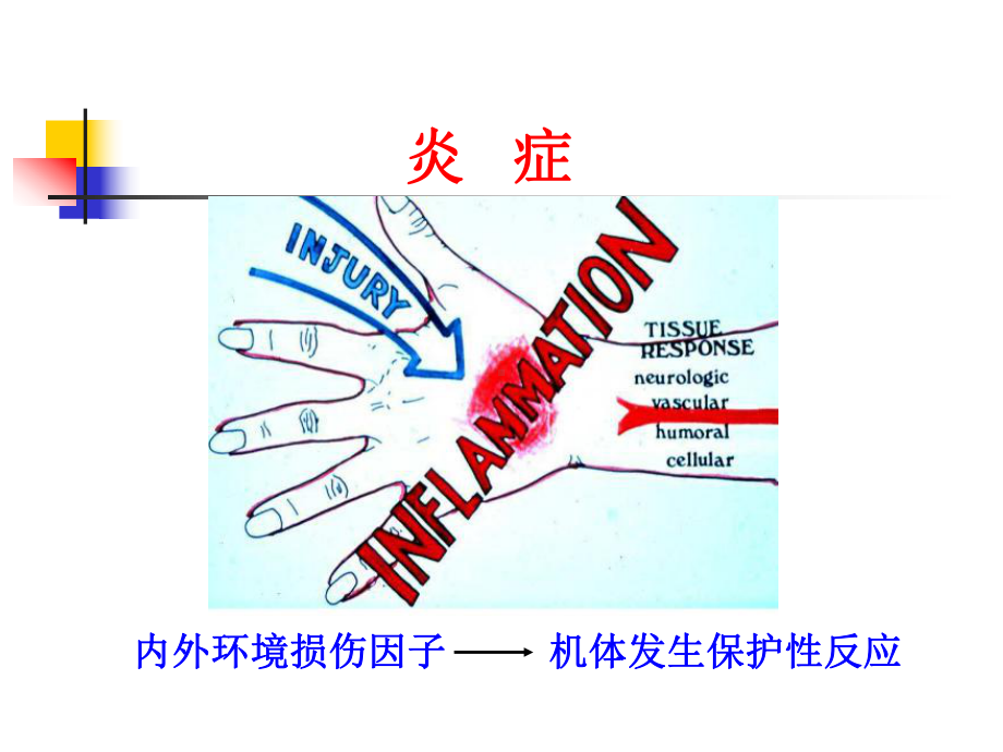 发炎病理学课件.ppt_第3页